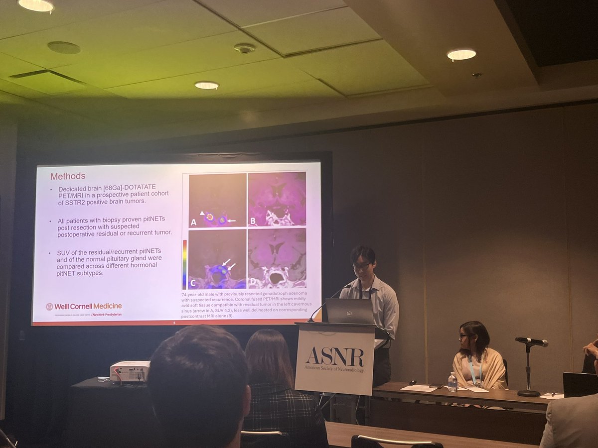 jana_ivanidze's tweet image. Excellent presentation by @WCMRadRes superstar Dr. Sean Kim on #DOTATATE in #pitNET 
@TheASNR #ASNR25
@WCMRadiology @MolecularWCM 
#proudmentormoment