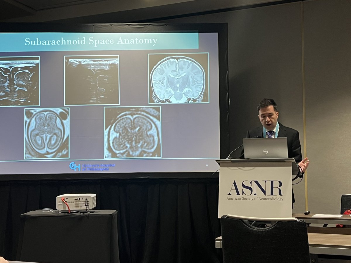crcerron's tweet photo. Congratulations to my dear friends on such outstanding presentations #asnr2025 @CHOP_Research @CHOPRadiology https://t.co/7CH3mwnPyD