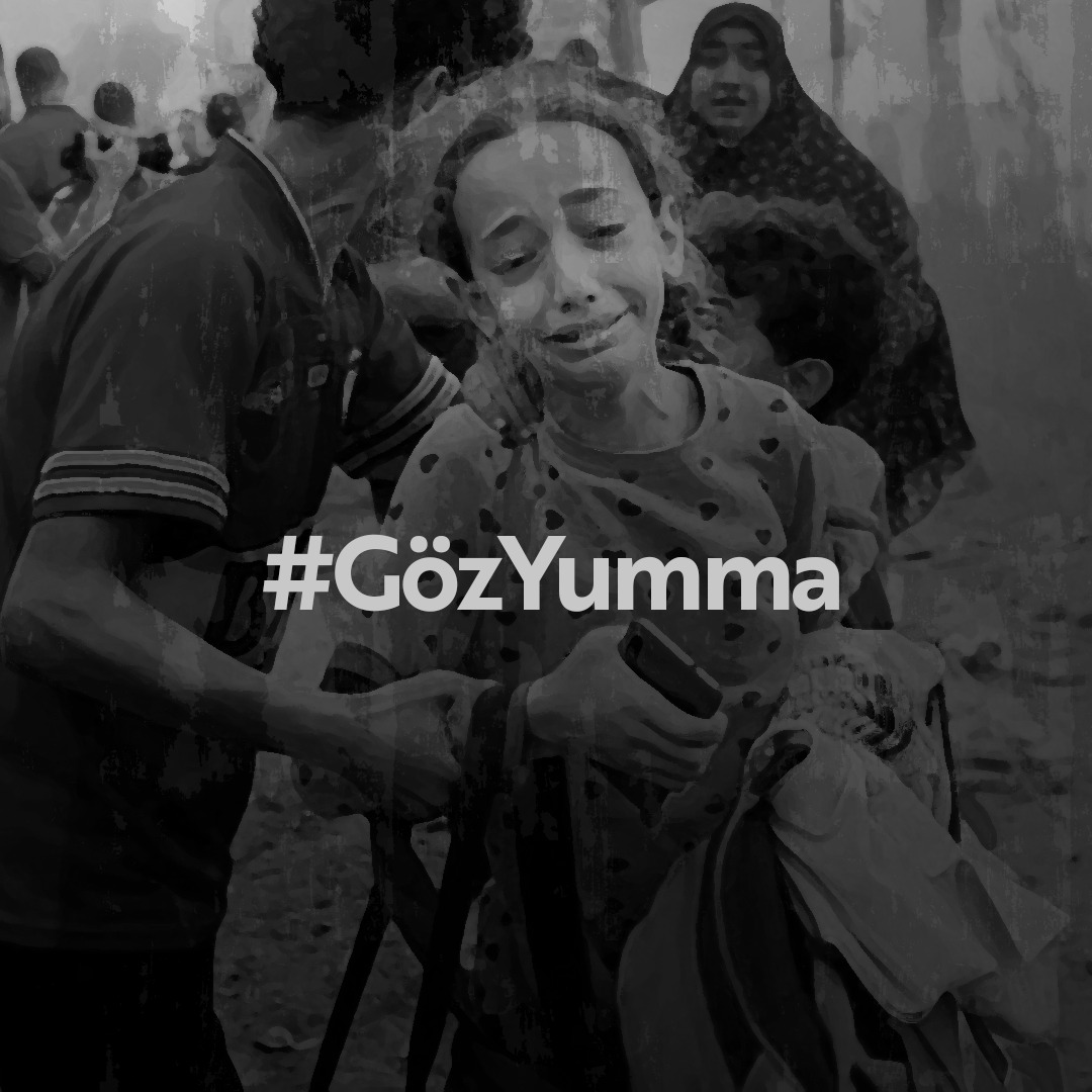 #GözYumma
