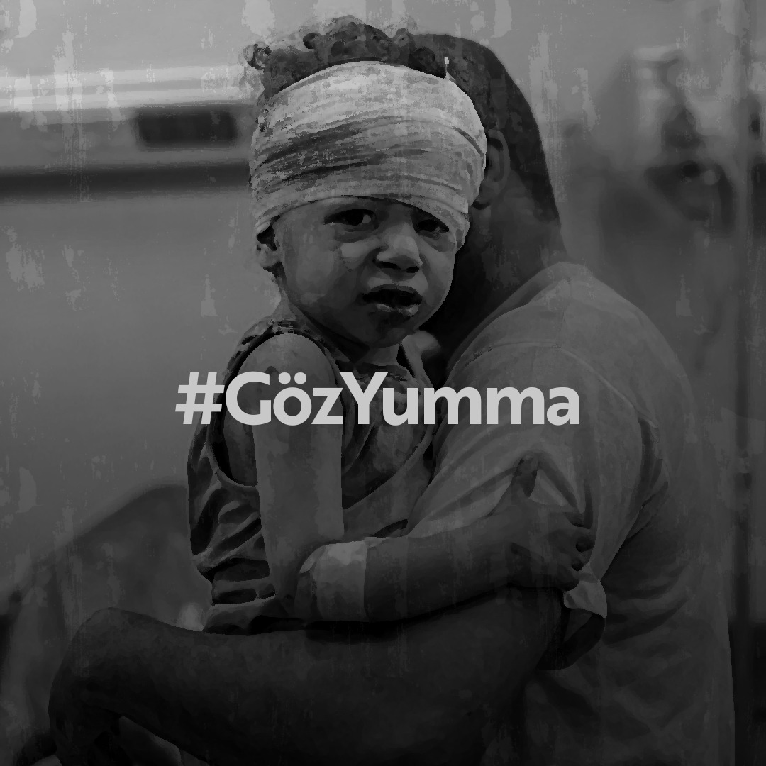 #GözYumma