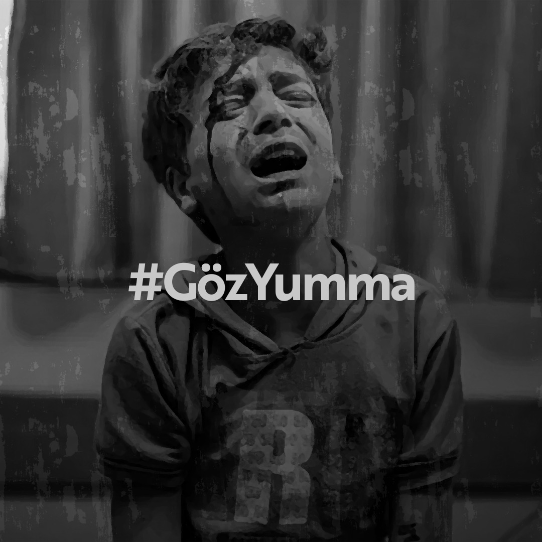 #GözYumma