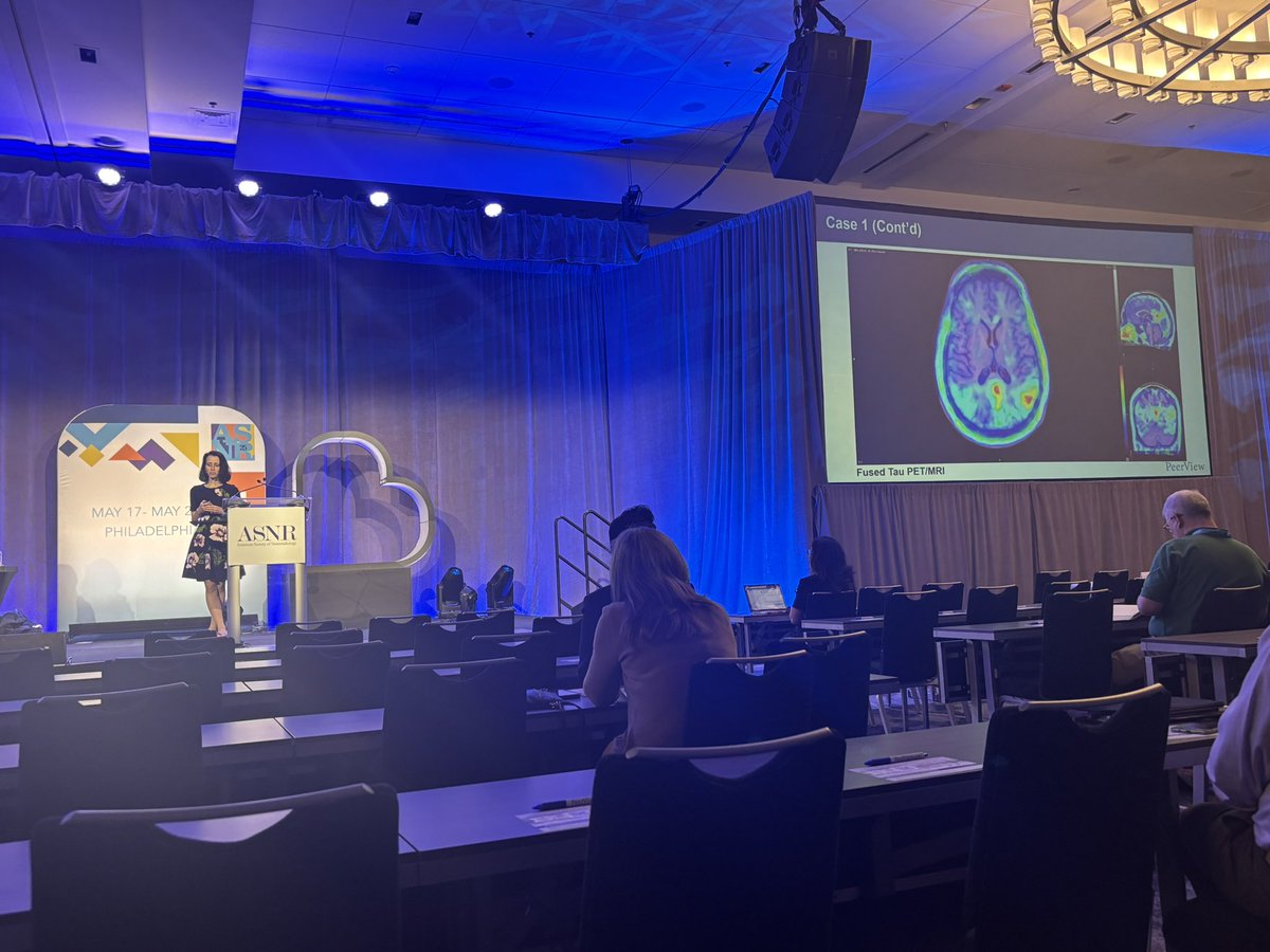 hana farzaneh (@farzanehhana) on Twitter photo Great talk by <a href="/GloriaChiangMD/">Gloria Chiang, MD</a> <a href="/AFrances_MDPhD/">Ana Franceschi, MD PhD</a> on Alzheimer’s disease#ASNR 2025 Great talk by <a href="/GloriaChiangMD/">Gloria Chiang, MD</a> <a href="/AFrances_MDPhD/">Ana Franceschi, MD PhD</a> on Alzheimer’s disease#ASNR 2025