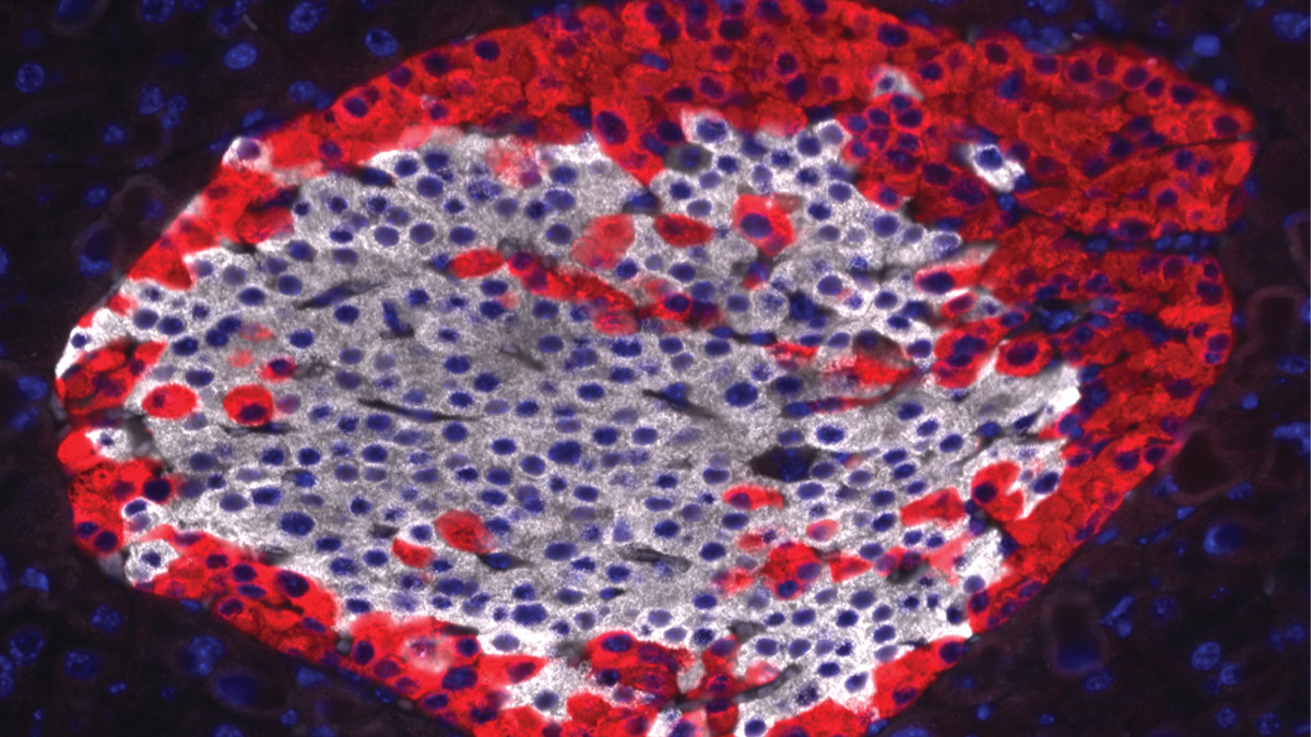 Diabetes, a research journal of the ADA 🧪 (@diabetes_ada) on Twitter photo 🚨The June 2025 issue of Diabetes has arrived! 🔗diabetesjournals.org/diabetes/issue…
Explore the latest research on #diabetes, including:
✨Effect of Small Increases in Blood Glucose
✨Plasma Angiogenin & Kidney Disease in T2D
✨& more!
<a href="/AmDiabetesAssn/">American Diabetes Association</a> <a href="/ADA_DiabetesPro/">American Diabetes Association - DiabetesPro</a> <a href="/ADA_Pubs/">ADA Professional Publications</a> 🚨The June 2025 issue of Diabetes has arrived! 🔗diabetesjournals.org/diabetes/issue…
Explore the latest research on #diabetes, including:
✨Effect of Small Increases in Blood Glucose
✨Plasma Angiogenin & Kidney Disease in T2D
✨& more!
<a href="/AmDiabetesAssn/">American Diabetes Association</a> <a href="/ADA_DiabetesPro/">American Diabetes Association - DiabetesPro</a> <a href="/ADA_Pubs/">ADA Professional Publications</a>