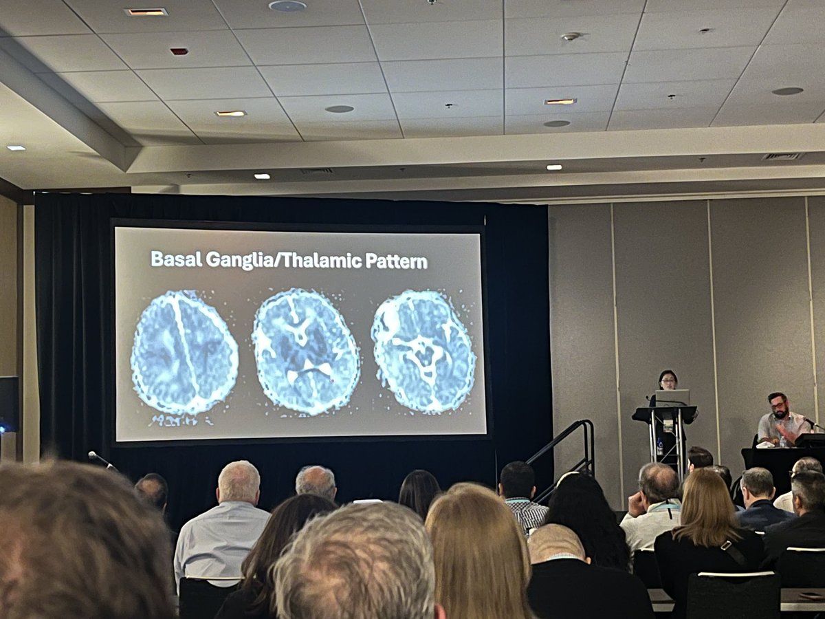Cynthia Xin Wu (@cynxinwu) on Twitter photo So glad that airplane engine issues didn’t keep me from making it to <a href="/YiLiMD/">Yi Li</a>’s amazing talk on #perinatal brain injury! Also the awesome <a href="/AdGoldmanYassen/">Adam Goldman-Yassen, MD, MS</a> modding! <a href="/TheASNR/">The American Society of Neuroradiology</a> #ASNR25 <a href="/The_ASPNR/">American Society of Pediatric Neuroradiology</a> So glad that airplane engine issues didn’t keep me from making it to <a href="/YiLiMD/">Yi Li</a>’s amazing talk on #perinatal brain injury! Also the awesome <a href="/AdGoldmanYassen/">Adam Goldman-Yassen, MD, MS</a> modding! <a href="/TheASNR/">The American Society of Neuroradiology</a> #ASNR25 <a href="/The_ASPNR/">American Society of Pediatric Neuroradiology</a>