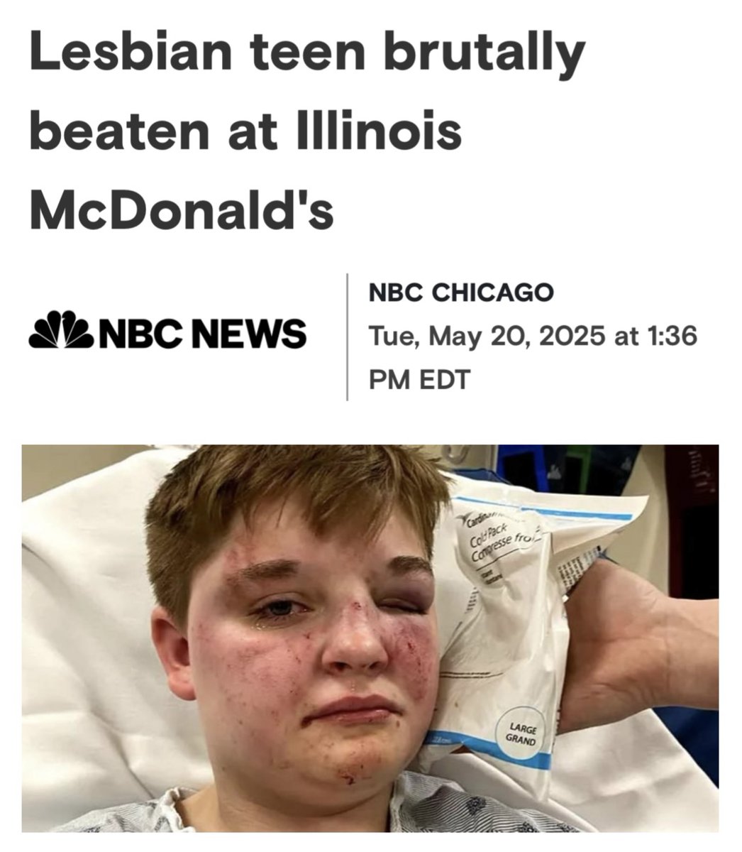 Guess why NBC didn't include images of the 2 teen suspects