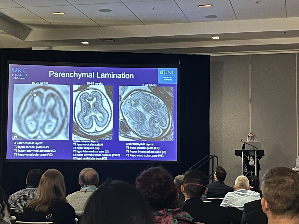 American Society of Pediatric Neuroradiology (@the_aspnr) on Twitter photo An excellent session focused on neonatal brain MRI at #ASNR25 with wonderful teaching from Yi Li, Cesar Alves, Suely Fazio Ferraciolli, and Carolina Guimaraes.
<a href="/cesaralvesneuro/">CESAR ALVES</a> <a href="/FazioSuely/">Suely Fazio Ferraciolli</a> <a href="/cguimaraesMD/">Carolina Guimaraes MD</a>
#pedrad #pedineurorad #neurorad An excellent session focused on neonatal brain MRI at #ASNR25 with wonderful teaching from Yi Li, Cesar Alves, Suely Fazio Ferraciolli, and Carolina Guimaraes.
<a href="/cesaralvesneuro/">CESAR ALVES</a> <a href="/FazioSuely/">Suely Fazio Ferraciolli</a> <a href="/cguimaraesMD/">Carolina Guimaraes MD</a>
#pedrad #pedineurorad #neurorad