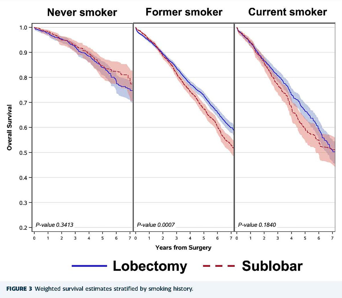The Annals of Thoracic Surgery (@annalsthorsurg) on Twitter photo #GeneralThoracic #CME article from <a href="/GavittWoodard/">Gavitt Woodard</a> et al on Lobectomy vs Sublobar Resection in The Society of Thoracic Surgeons Database: Importance of Patient Factors and Lymph Node Evaluation: doi.org/10.1016/j.atho…
<a href="/BUdelsman/">Brooks Udelsman</a> <a href="/EADavidMD/">Elizabeth A David MD</a> <a href="/JeffJacobs215/">Jeff Jacobs</a> <a href="/DrBlasberg/">Dr. Justin D. Blasberg</a> #GeneralThoracic #CME article from <a href="/GavittWoodard/">Gavitt Woodard</a> et al on Lobectomy vs Sublobar Resection in The Society of Thoracic Surgeons Database: Importance of Patient Factors and Lymph Node Evaluation: doi.org/10.1016/j.atho…
<a href="/BUdelsman/">Brooks Udelsman</a> <a href="/EADavidMD/">Elizabeth A David MD</a> <a href="/JeffJacobs215/">Jeff Jacobs</a> <a href="/DrBlasberg/">Dr. Justin D. Blasberg</a>