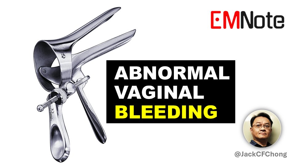 Abnormal Vaginal Bleeding. 
youtu.be/EggusjB0VtE&ll…
Abnormal vaginal bleeding categorized by pregnancy status, pre-menarche, post-menopause.