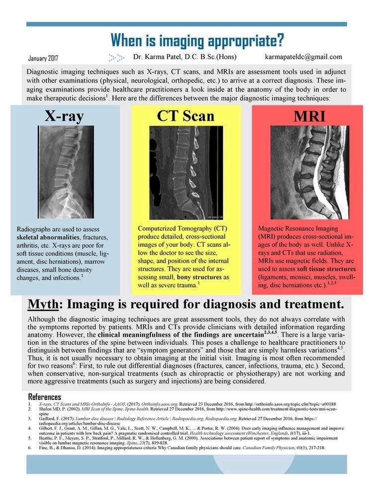AB_drmd's tweet photo. وش الفرق بين X-ray وCT وMRI، و متى نستخدم كل نوع؟

📸 أولاً: X-ray – الأشعة العادية
هذي تعتبر الجندي الأول في التصوير. سريعة، رخيصة، وموجودة بكل مكان.
🦴 تستخدمها لما تبغى تشوف:
- كسور
- تغيّرات في العظام
- Arthritis
- أمراض نخاع العظم أو العدوى
لكن انتبه! 😬 X-ray ما تصلح لـ soft tissue زي الأربطة، العضلات، أو الغضاريف. يعني لو واحد يشتكي من ألم ظهر بسبب disc herniation، X-ray غالبًا ما راح يبيّن شي.

🟨 ثانيًا: CT Scan – الأشعة المقطعية
هنا تدخل على المرحلة الجدية 😤
 CT Scan يعطيك صور مقطعية 3D للجسم. ممتازة في تحديد الحجم، الشكل، ومكان الأشياء، خصوصًا العظام أو النزيف أو الأورام.
🧠 تستخدمها متى؟
- تشك في trauma (نزيف داخلي، كسر صغير)
- تبغى تشوف عظام أو أورام
- لما تبغى تصور بسرعة، والمريض ما يقدر يدخل جهاز MRI
لكن ترى تستخدم Radiation كثير، فانتبه خصوصًا مع الأطفال أو الحوامل 🚫

🟥 ثالثًا: MRI – التصوير بالرنين المغناطيسي
الوحش الفخم 👑
ما يستخدم أشعة، بل مغناطيس قوي، ويعطيك تفاصيل دقيقة جدًا، خصوصًا للأنسجة الطرية.
🧬 ممتاز عشان:
- تشوف الأربطة، الغضاريف، الديسك
- تورم أو التهابات
- Tumors
- مشاكل في Spinal cord أو Brain
بس فيه سلبيات:
- ياخذ وقت
- غالي
- مو كل مريض يقدر يسويه (مثل اللي عنده pacemaker أو معدن بالجسم)

❌ Myth لازم نفجره!
يعتقد كثير من الناس (حتى بعض الدكاترة 😅) إن التصوير ضروري عشان التشخيص والعلاج. لكن الواقع؟ لا.
🤓 الحقيقة:
- ممكن المريض يشتكي من ألم، وتكون الأشعة سليمة.
- وممكن يكون عنده مشاكل في الأشعة، بس ما يحس بأي شي!
يعني، التصوير أداة، مو تشخيص بحد ذاته.
ومو دايم لازم تبدأ فيه.
غالبًا نستخدم التصوير لما:
1. نبغى نستبعد أشياء خطيرة (سرطان، كسر، عدوى).
2. العلاج المحافظ (زي العلاج الطبيعي أو مسكنات) ما نفع.

ملخص:
X-ray = ممتاز للعظام، ضعيف في الأنسجة الطرية
CT = سريع، يوضح التفاصيل الدقيقة، ممتاز في النزيف والعظام، لكنه يشعّ كثير
MRI = الأفضل للأنسجة الطرية (أربطة، غضاريف، دماغ، نخاع شوكي)
لا تعتمد على الأشعة فقط، لازم تقارنها بالأعراض والتاريخ والفحص
التصوير ما هو دايم ضروري، خصوصًا في البداية