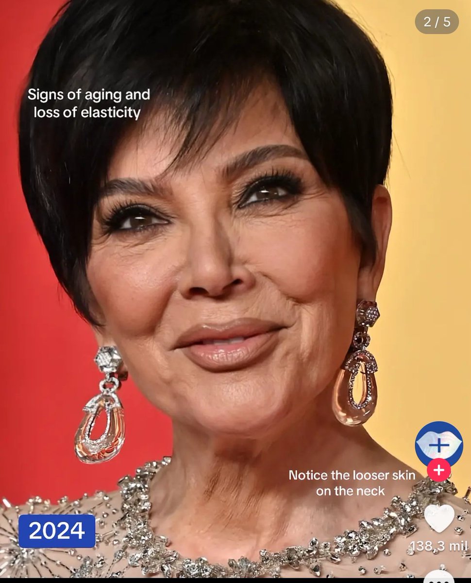 mmmifla's tweet photo. realmente hay un mundo de medicina estética al que la mayoría de los mortales jamás podríamos aspirar a imaginar https://t.co/GFrU3Vg9AS