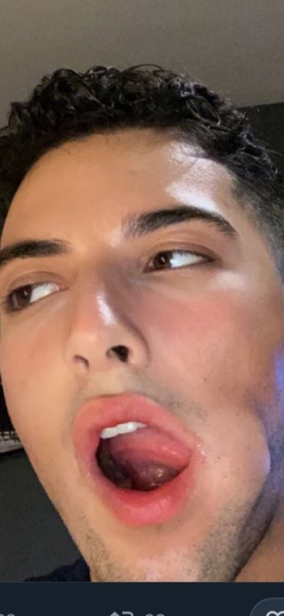 BenjaMyr's tweet image. On en parle svp ? 💀 #LGBT #Cassos