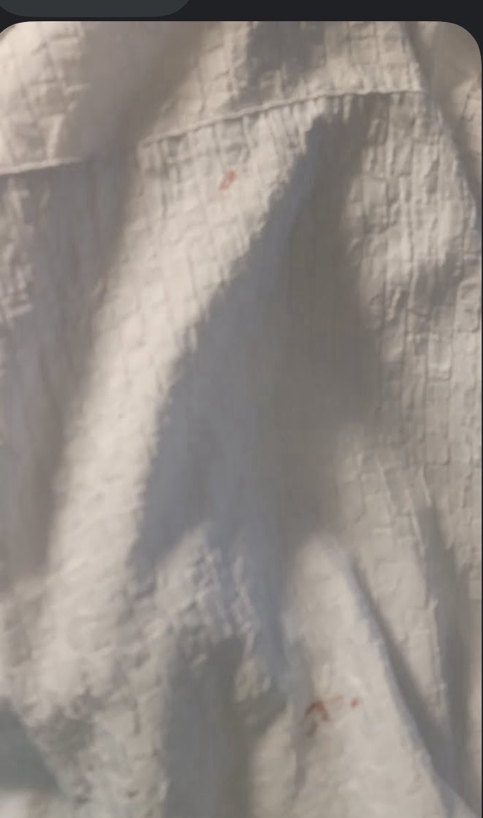 JihadHMuhammad's tweet photo. @HiltonHotels how you allow SOMEONE ELSE’s BLOOD, a bio hazard, on the pillow, sheets and bed in your hotels, YOUR CLEANING STAFF DOESN’T CLEAN  ANYMORE, WOW in @HomewoodSuites on Poydras https://t.co/AQlM8r2zeu