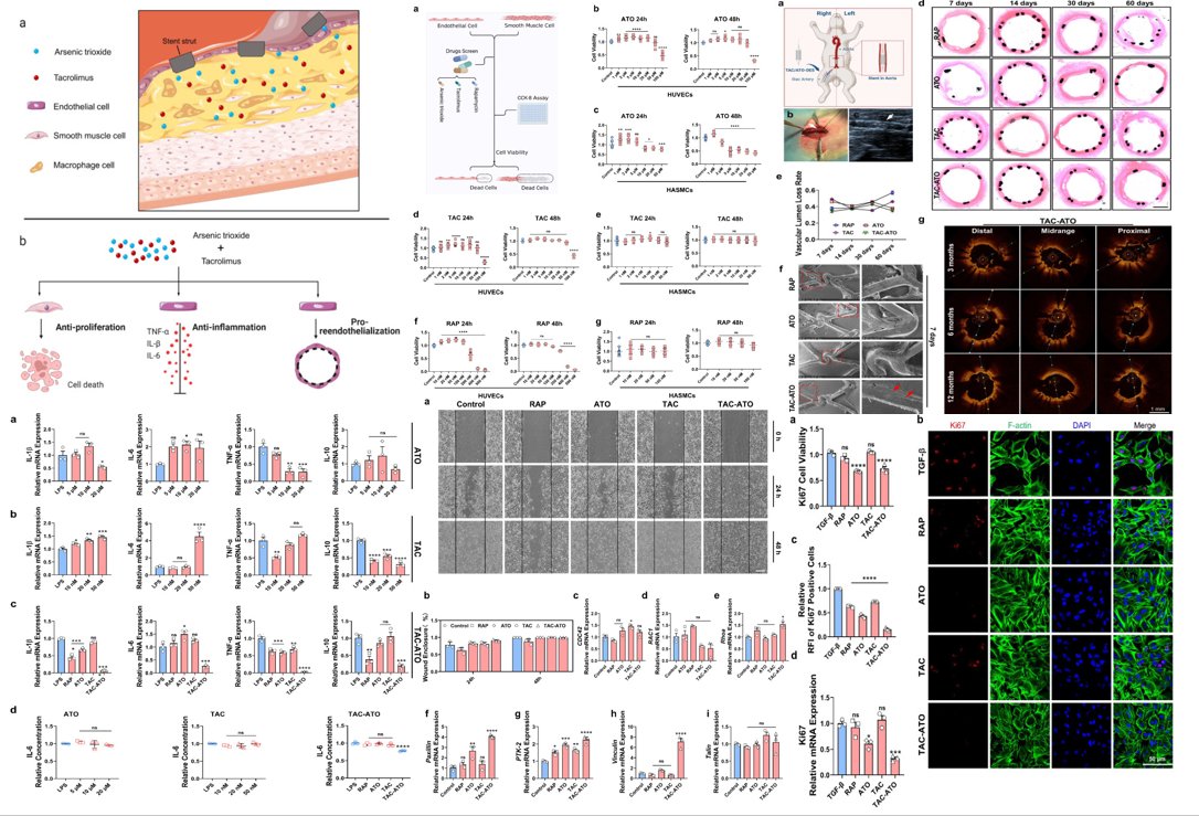 Tacrolimus combined with arsenic trioxide provides a three-in-one drug-eluting coronary stent integrating anti-restenosis, pro-endothelialization and anti-inflammation
sciencedirect.com/science/articl…
#Tacrolimus #Arsenic trioxide #Drug-eluting stent #MedTwitter #scicomm #MedEd