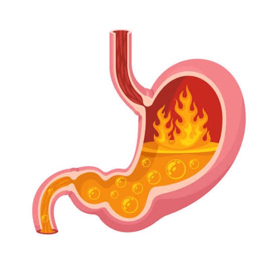 shyam_ayurved's tweet photo. 🧵Thread : say bye to H pylori with this powerful Herbal combo.🌿🔥

If you are struggling with gastric ulcers, bloating, or acid reflux- H pylori might be the hidden culprit.

Here’s a natural remedy, backed by science to fight it off.

Let’s dive in 👇 https://t.co/YiV7llWjWn
