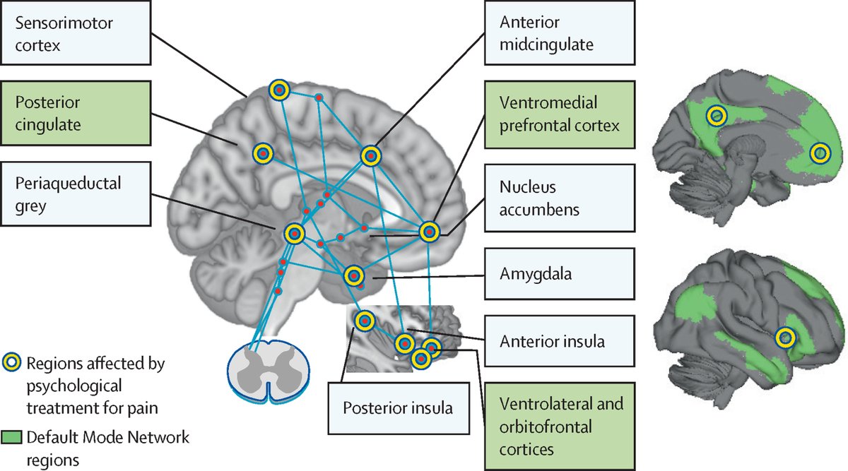 One in five of the population lives with chronic pain.

In a new Review, authors discuss core principles for psychological pain management and practical advice for how to facilitate pain self-management in clinical practice: hubs.li/Q03nhlSq0