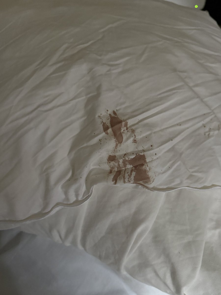 malacey_'s tweet photo. @bookingcom is it possible to get money back after having a hellish stay? Just back from staying at Cambridge Court Sussex Gardens, London. The sofa bed was not fit for purpose and when I took the pillow cover off the pillow was blood stained… 2nd part in follow up.. https://t.co/5hU0nhGvhq
