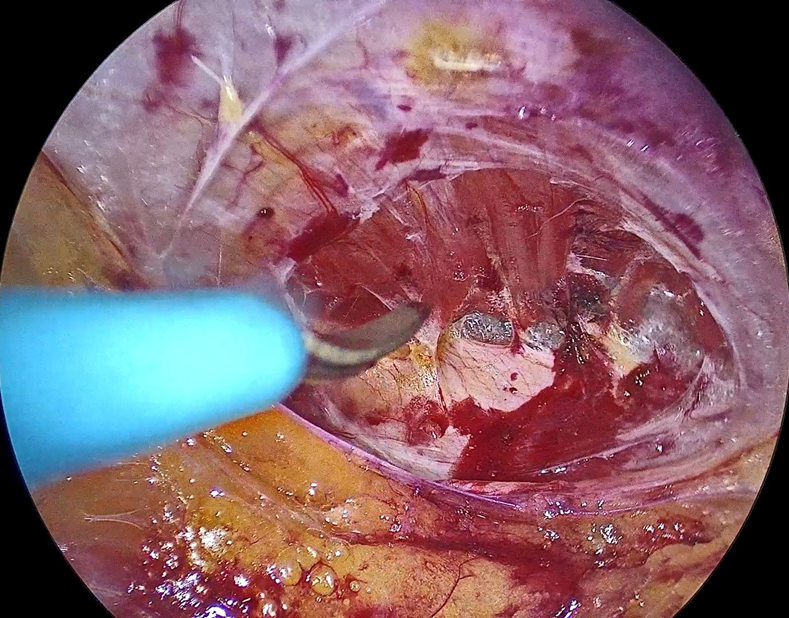 Carlos Bustamante. MD. PhD tweet media