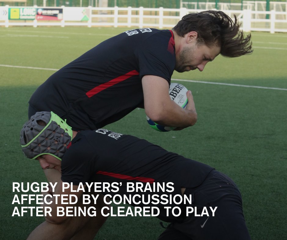 University of Essex (@uni_of_essex) on Twitter photo A study into grassroots rugby concussion found players’ brains are still affected after being cleared to play.
Led by Dr Ben Jones of <a href="/SRES_UoE/">Sport-Rehab-Ex UOE</a>, the study found seven out of eight concussed players still had abnormal brain responses 25 days after injury.
brnw.ch/21wSOen A study into grassroots rugby concussion found players’ brains are still affected after being cleared to play.
Led by Dr Ben Jones of <a href="/SRES_UoE/">Sport-Rehab-Ex UOE</a>, the study found seven out of eight concussed players still had abnormal brain responses 25 days after injury.
brnw.ch/21wSOen
