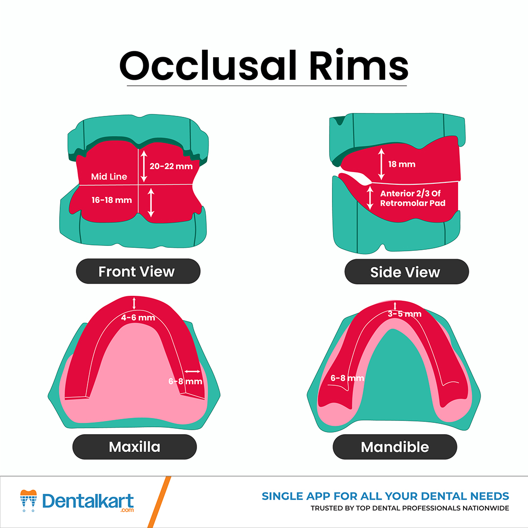 Dentalkart's tweet image. 𝐄𝐬𝐬𝐞𝐧𝐭𝐢𝐚𝐥 𝐆𝐮𝐢𝐝𝐞 𝐭𝐨 𝐎𝐜𝐜𝐥𝐮𝐬𝐚𝐥 𝐑𝐢𝐦𝐬 🔴
 
Occlusal rims are key to recording vertical dimension, centric relation &amp;amp; esthetics in complete dentures. 

 Get the ideal measurements right for clinical success! 

 #Prosthodontics #DentalLearning #OcclusalRims