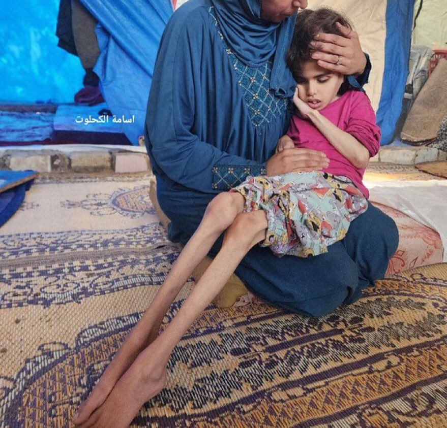 La ONU denuncia hoy que Israel NO PERMITE el paso de la ayuda humanitaria a Gaza. 
Netanyahu utiliza el hambre para exterminar al pueblo gazatí.