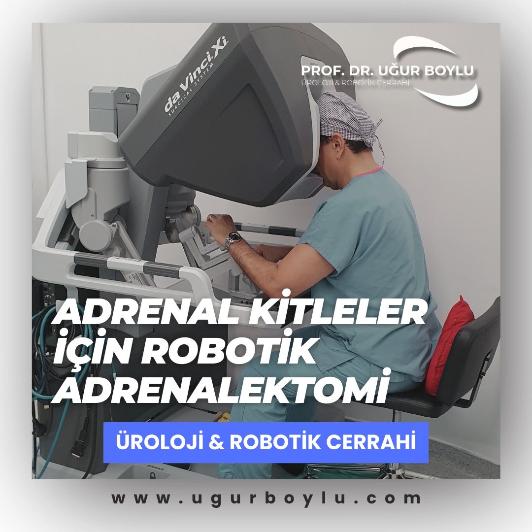 Adrenal kitleler genellikle iyi huyludur ancak hormon salgılayabilir ya da malign olabilir. 4 cm’den büyük ya da hormon aktif kitlelerde cerrahi önerilir. Robotik cerrahi; az kanama, hızlı iyileşme ve hassas diseksiyon ile öne çıkar.
#adrenal #roboticadrenalectomy