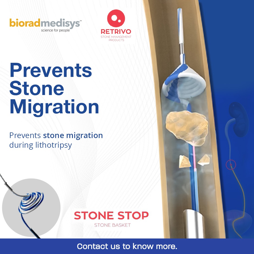 Stop stone migration before it starts.

#BioradMedisys Stone Stop is designed to prevent stone migration to the kidney during lithotripsy — ensuring better control, fewer complications, and improved patient outcomes in ureteric stone procedures.

Contact us: +91 8605422000