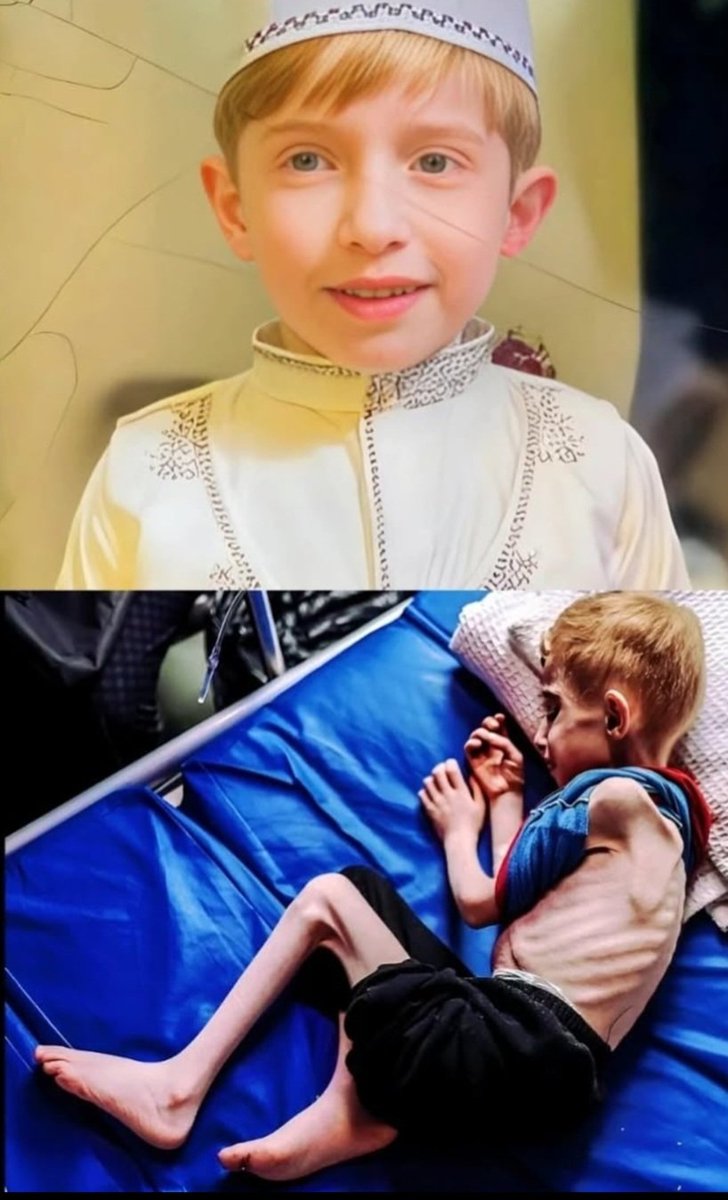 Gazze'de tablo budur‼️‼️