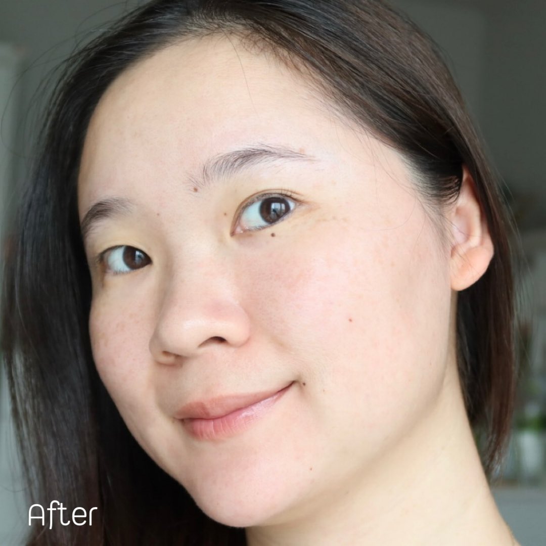 ใครเป็นสิวอุดตัน ไม่ต้องไปบีบไปเค้นให้เจ็บอีกต่อไป~ 
ลองลาโรชขวดนี้เลยค่า Effaclar serum ตัวนี้ช่วยสลายสิวอุดตัน คือตัดจบปัญหาสิวไปได้เลย
เซรั่มจบปัญหาสิวที่ต้นตอ ไม่ว่าจะสิวอักเสบ อุดตัน หรือ สิวเสี้ยน สิวบุกเมื่อไหร่ต้องรีบหยิบตัวนี้มาใช้เลย

🩵bit.ly/3Pm57tA