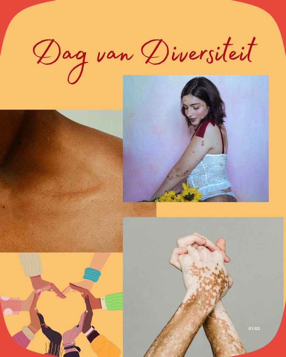 Vandaag vieren we de kracht van diversiteit – in uiterlijk én karakter. Iedereen is uniek, en dat maakt onze samenleving mooier. Ook mensen met moedervlekken horen er helemaal bij. Samen maken we het verschil!🤩
#DagVanDiversiteit #UniekIsMooi #SamenSterk #NevusNetwerk
