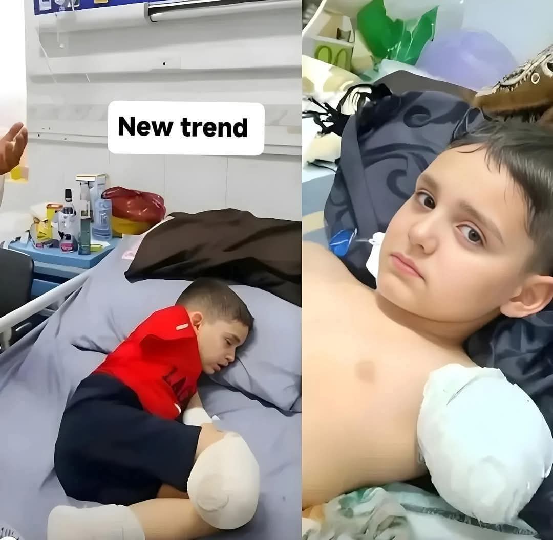 This child went to bed hungry and woke up in the hospital with his leg and hand amputated 💔😢