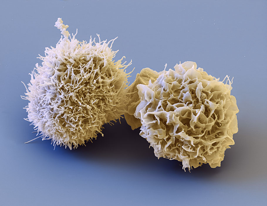 SciImmunology's tweet photo. A new Science #Immunology study uncovers the hierarchy of transcriptional signals that guide type I conventional dendritic cell development (#cDC1) from #myeloid progenitors in mice. https://t.co/stvtqL9ZPb https://t.co/8al2TVIEg5