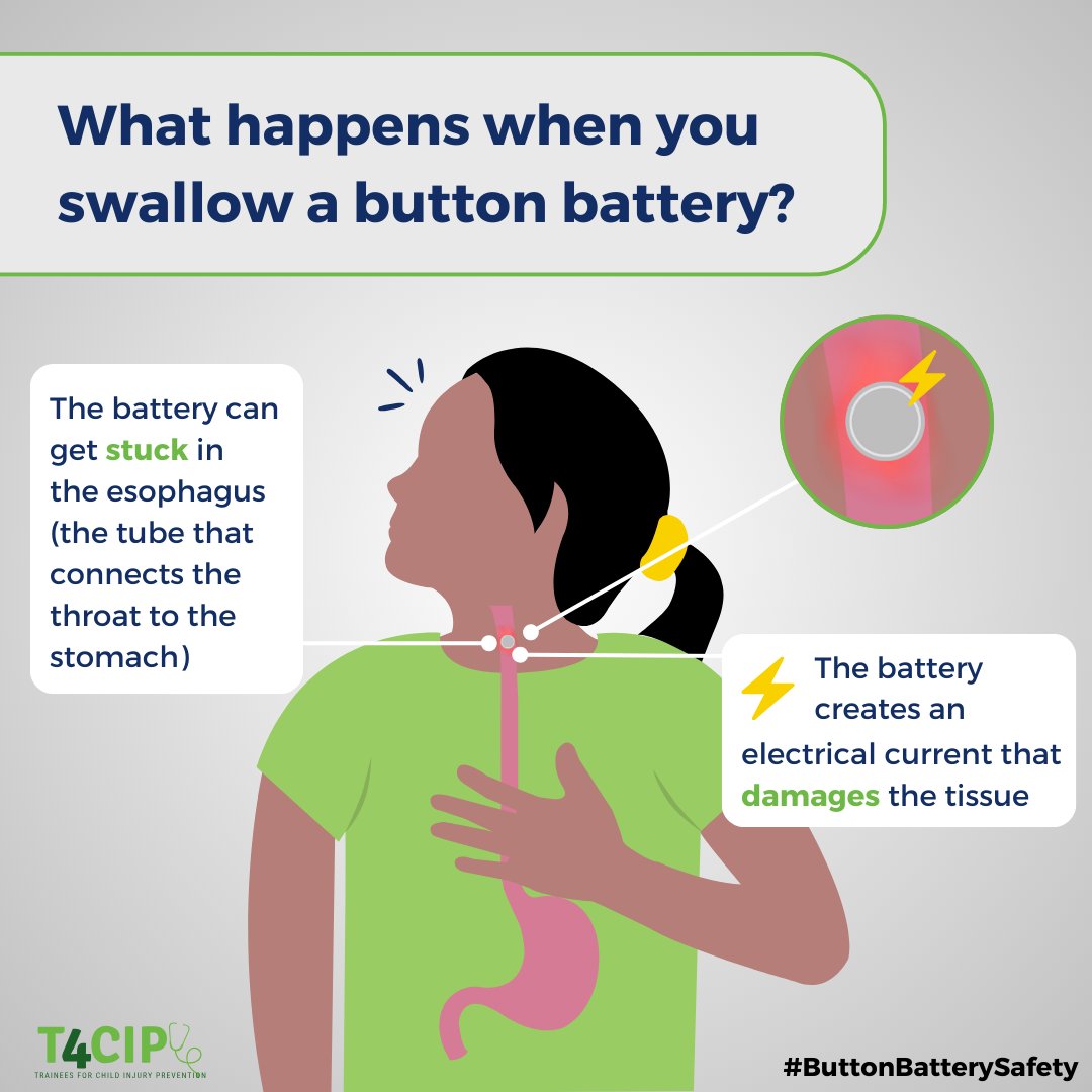 A4: When a child swallows a button battery, the battery can get stuck in the esophagus (the tube that connects the throat to the stomach). The battery creates an electrical current that damages tissue. Life-long swallowing difficulty &amp; even death can occur. #ButtonBatterySafety