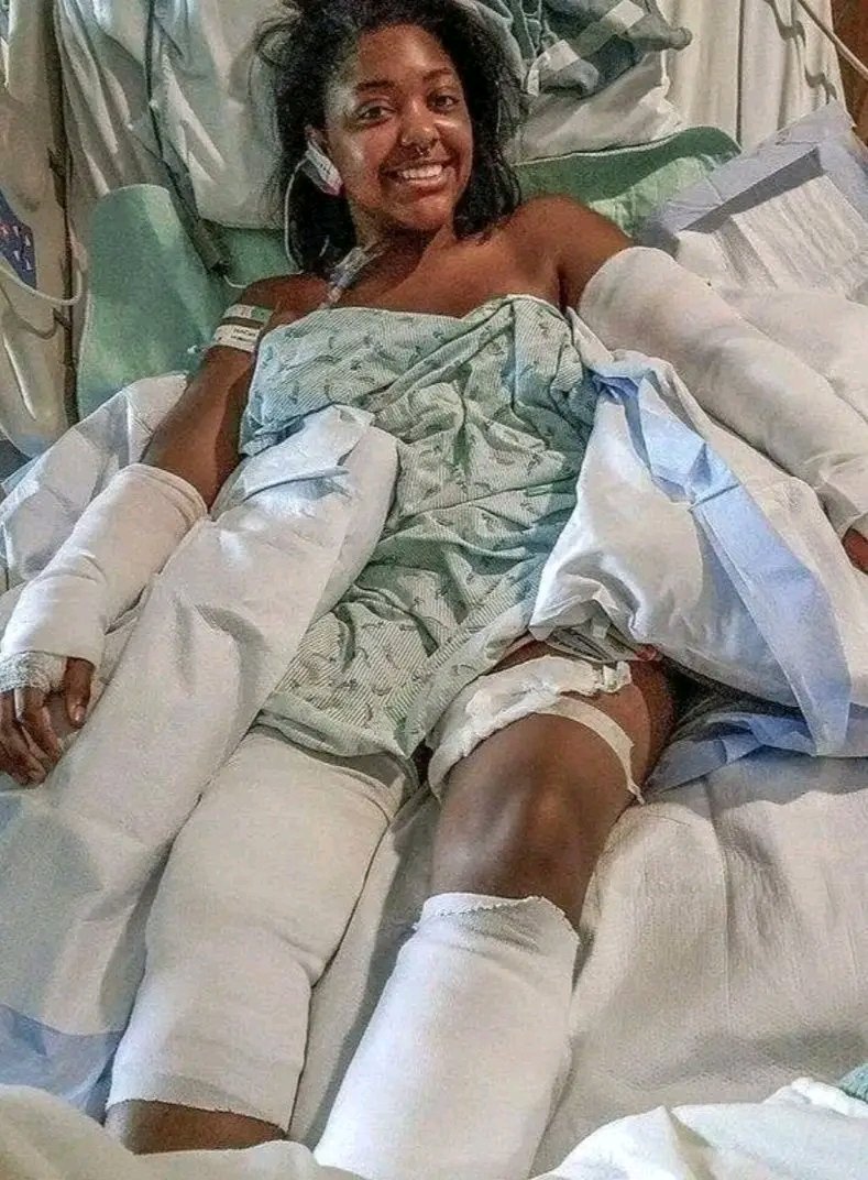 The is woman is a trooper! She's a survivor and huge hero! Felicia Hambrick was babysitting her friend's three children when the family dog attacked her! The pit bull knocked her to the ground as she was holding an eight-month-old baby girl, but Felicia used her body to shield