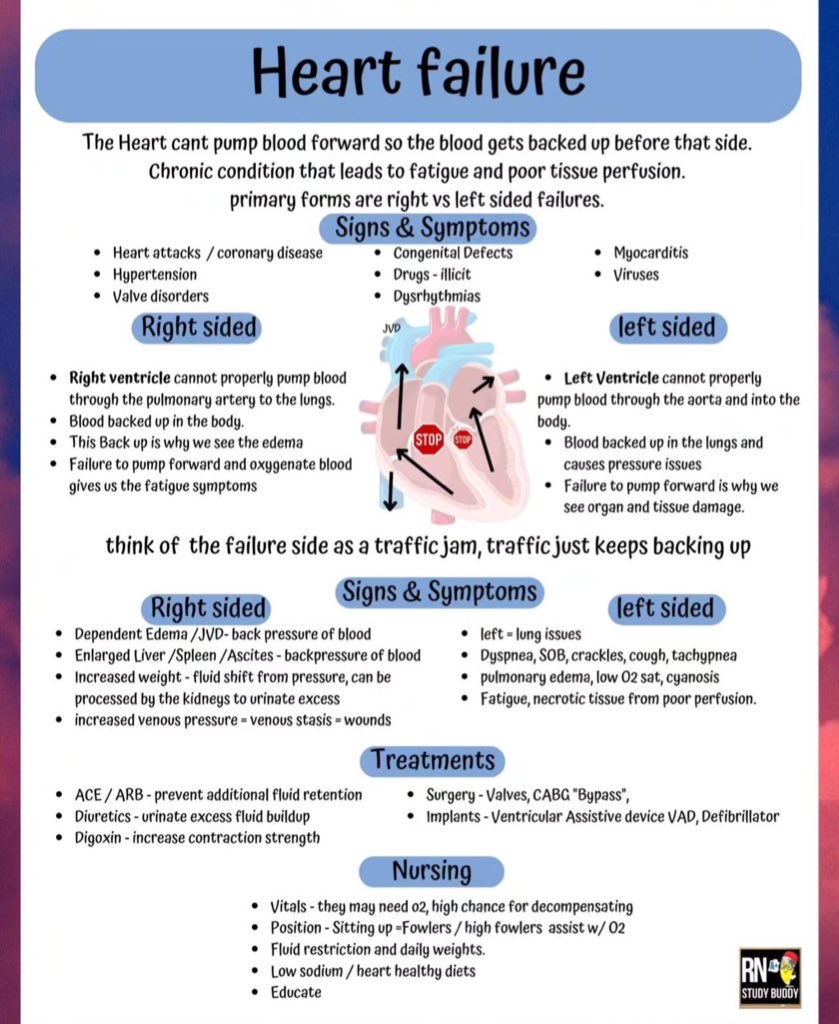 AB_drmd's tweet photo. ايش هو Heart Failure أو بالعربي "فشل القلب”؟
القلب ما يقدر يضخ الدم بشكل كافي للأمام، فيبدأ الدم يتجمع قبل الجهة اللي خربانة. وهذي الزحمة تسبب أعراض وتعب ومشاكل في أعضاء الجسم. في نوعين رئيسية من الفشل:
- Right sided heart failure
- Left sided heart failure
خلنا نشرح الفرق بينهم:

💔 فشل القلب الأيمن - Right Sided Heart Failure
تخيل إن Right ventricle هو السواق اللي مسؤول يرسل الدم للرئة عبر pulmonary artery. لو هذا السواق نام على الطارة (يعني ما يشتغل زين)، الدم ما يقدر يوصل للرئة، فيبدأ يرجع للخلف... للأسف يرجع على شكل تجمع دم في الجسم 😩.
🔴 هذا اللي يسبب:
- Edema خصوصًا في الرجلين والكاحلين – لأن السوائل تتجمع من الضغط
- JVD (انتفاخ الأوردة في الرقبة) – علامة مشهورة
- تضخم الكبد والطحال ووجود Ascites (سوائل في البطن) – لأن الدم راجع للكبد والطحال
- زيادة الضغط الوريدي → يسبب جروح مزمنة من قلة التروية

💔 فشل القلب الأيسر - Left Sided Heart Failure
الحين نجي للسواق الثاني: Left ventricle، هذا مسؤول عن إرسال الدم لباقي الجسم. لو صار فيه مشكلة، الدم ما يطلع للأمام، فيبدأ يتجمع وين؟ في الرئة 😵‍💫.
🔵 هذا اللي يسبب:
- Dyspnea (ضيق تنفس)، SOB (shortness of breath)، tachypnea (تنفس سريع)
- صوت crackles بالرئة
- Pulmonary edema (سوائل في الرئة) → المريض يحس كأنه بيغرق 
- انخفاض في oxygen saturation → ممكن يوصل للزرقة (cyanosis)
- Fatigue لأن ما في أكسجين ودم كفاية يوصل للأعضاء

🎯 إيش الأشياء اللي تسبب Heart Failure؟
Myocardial infarction أو جلطات القلب
Hypertension ضغط مرتفع لفترة طويلة
Valve disease مشاكل في صمامات القلب
Myocarditis أو viruses
Congenital defects
تعاطي drugs مثل الكوكايين أو الأمفيتامين
Arrhythmias (مشاكل في نظم القلب)

💊 العلاج - Treatments
نعالج heart failure كأننا نحاول نفتح الزحمة في الطريق 🚧:
🩺 أدوية:
ACE inhibitors أو ARBs → تمنع احتباس السوائل
Diuretics → تخلي المريض يبول أكثر عشان ينزل السوائل
Digoxin → يقوي ضخ القلب
🛠 تدخلات:
جراحة في valves
عملية CABG (bypass)
زرع VAD (جهاز يساعد في ضخ الدم)، أو defibrillator