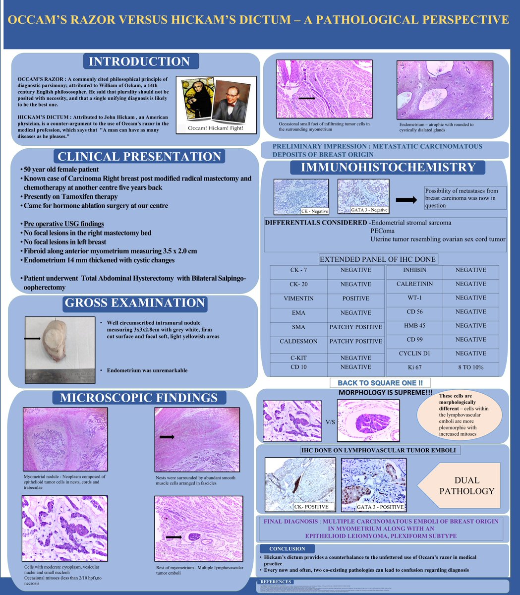 BAGPGynPath's tweet photo. Occam’s razor versus Hickam’s dictum – a pathological perspective: A rare case of two coexisting pathologies leading to confusion regarding diagnosis  #HilaryBuckleyAward #BAGP2025 https://t.co/opyG409p44