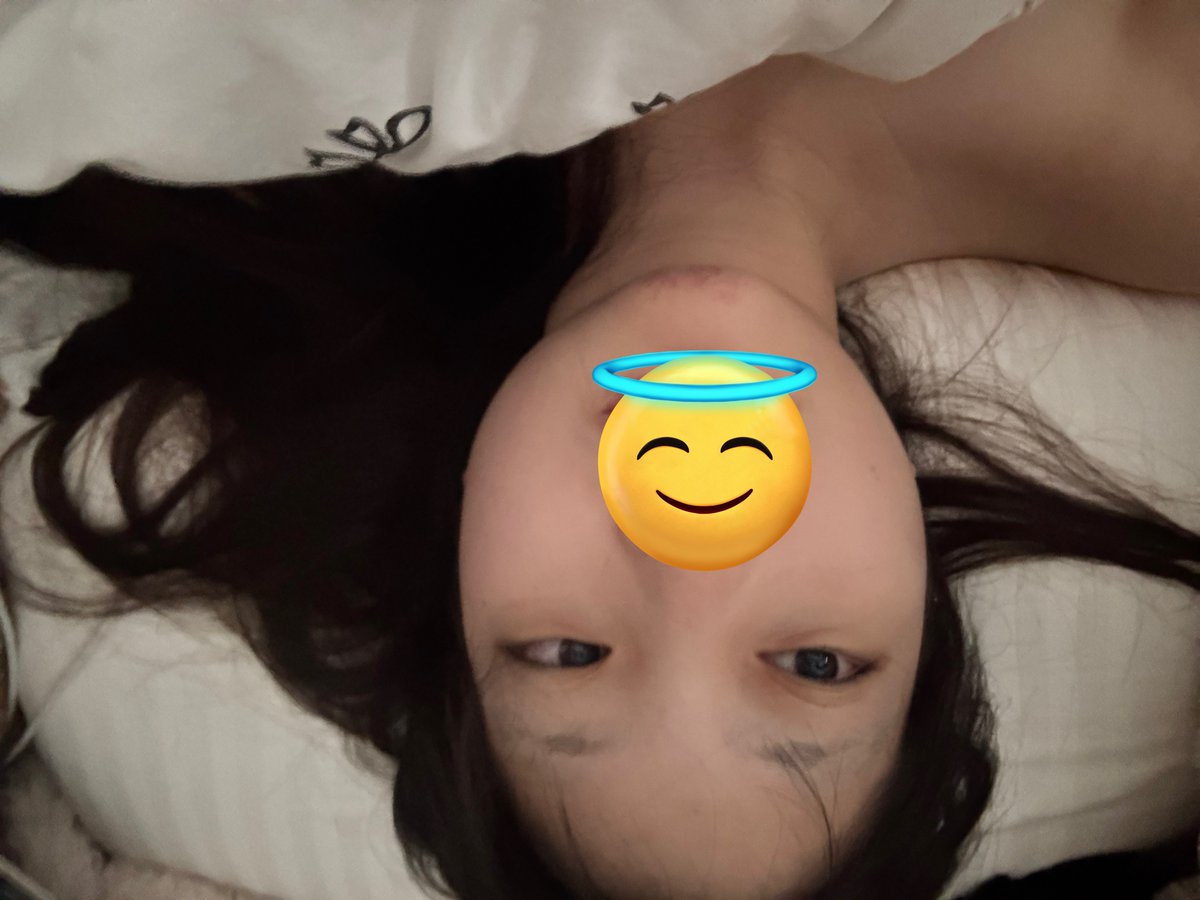 Cosholic結束之後就去拔了智齒
腫得好大 好像天竺鼠🥹