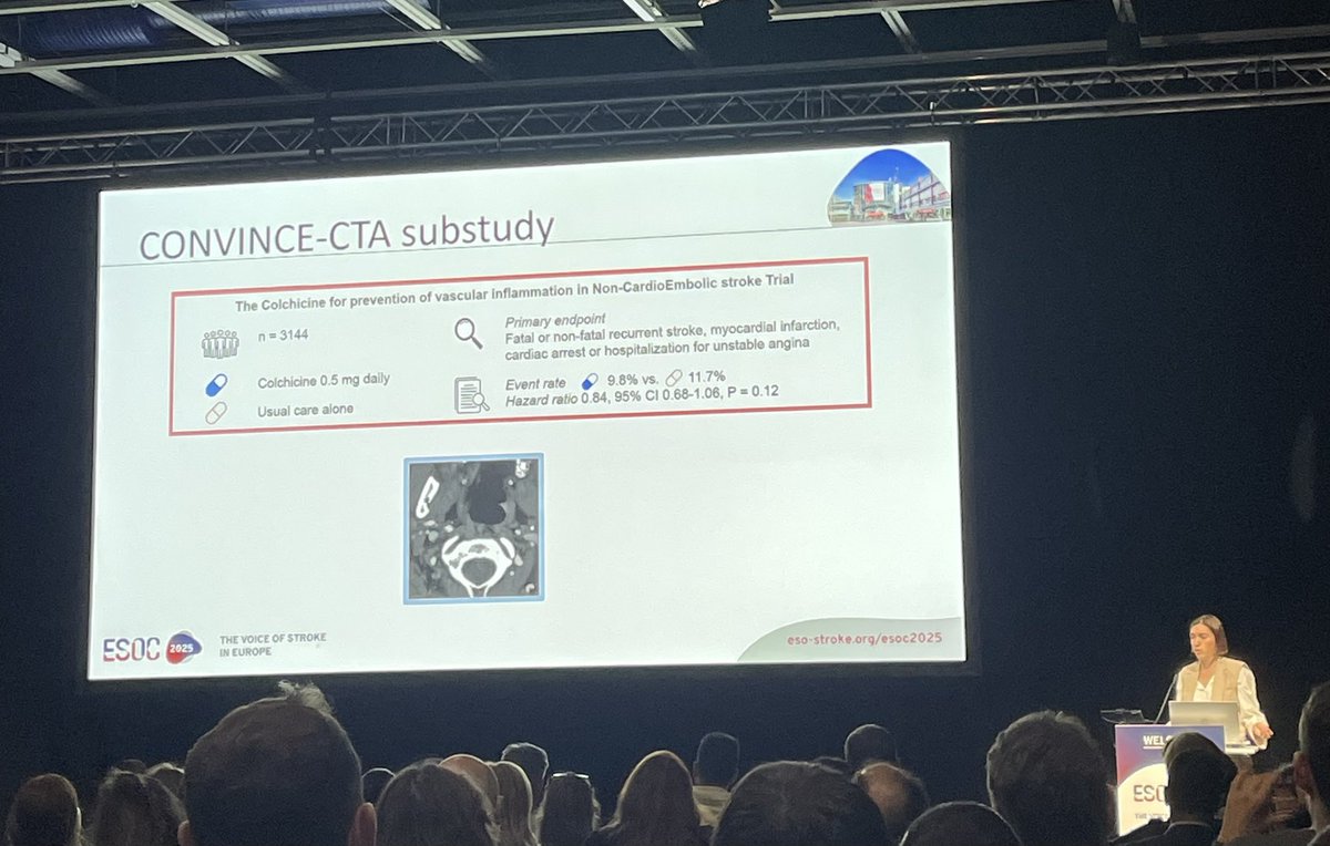 Sarah Gorey (@sarah_gorey) on Twitter photo Nice to see Louise Maes’ work on CTA high risk features of carotid plaque from CONVINCE <a href="/SCTNIreland/">Stroke Clinical Trials Network Ireland (SCTNI)</a> <a href="/ESOstroke/">European Stroke Org</a> #VoiceofStroke #CONVINCE Nice to see Louise Maes’ work on CTA high risk features of carotid plaque from CONVINCE <a href="/SCTNIreland/">Stroke Clinical Trials Network Ireland (SCTNI)</a> <a href="/ESOstroke/">European Stroke Org</a> #VoiceofStroke #CONVINCE