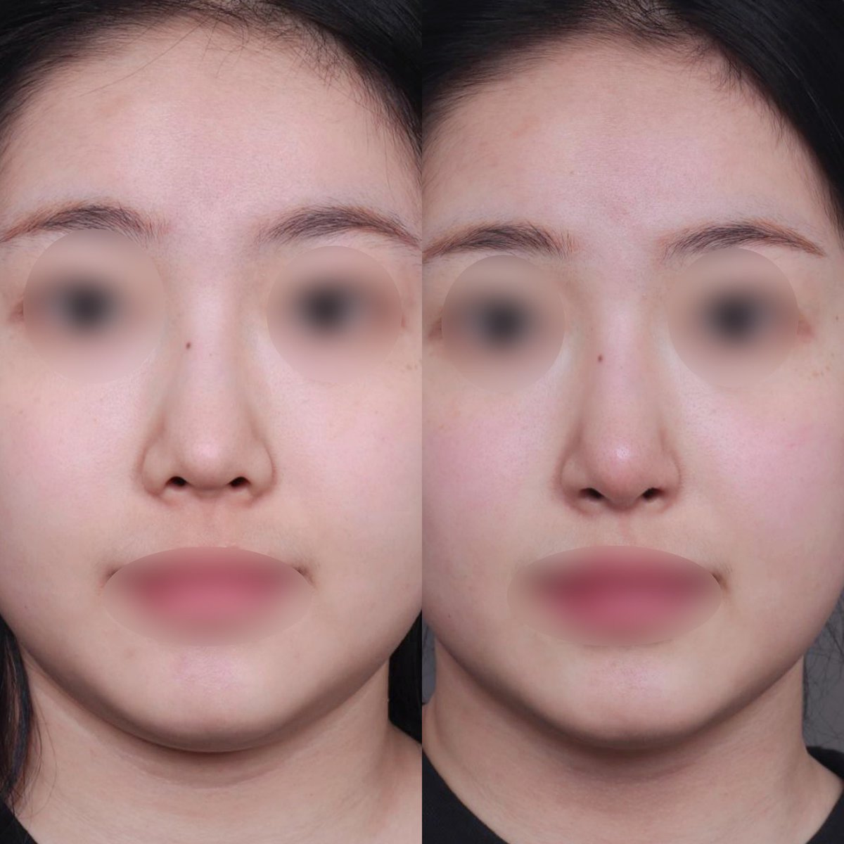 【公式】温度美容外科/ オンド美容外科 tweet media