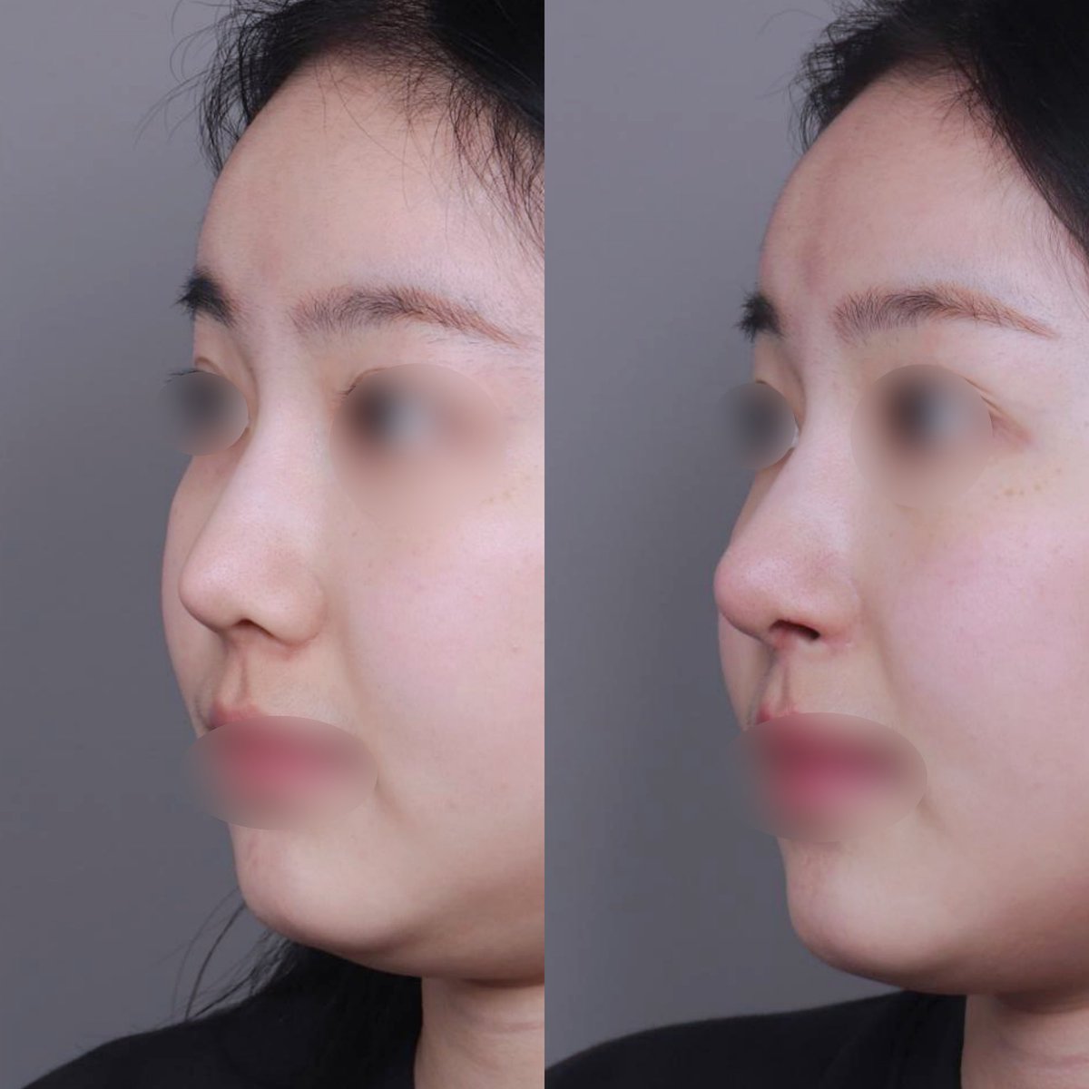 【公式】温度美容外科/ オンド美容外科 tweet media