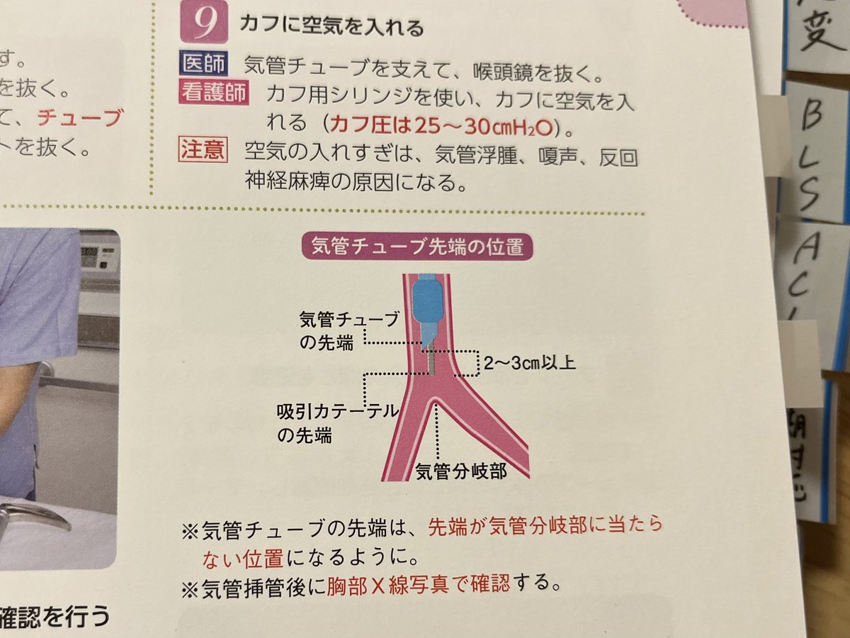 AF___o9's tweet photo. 人工呼吸器初めましての人にはここらへん一緒に確認するメモ https://t.co/7Coe5m7jJH