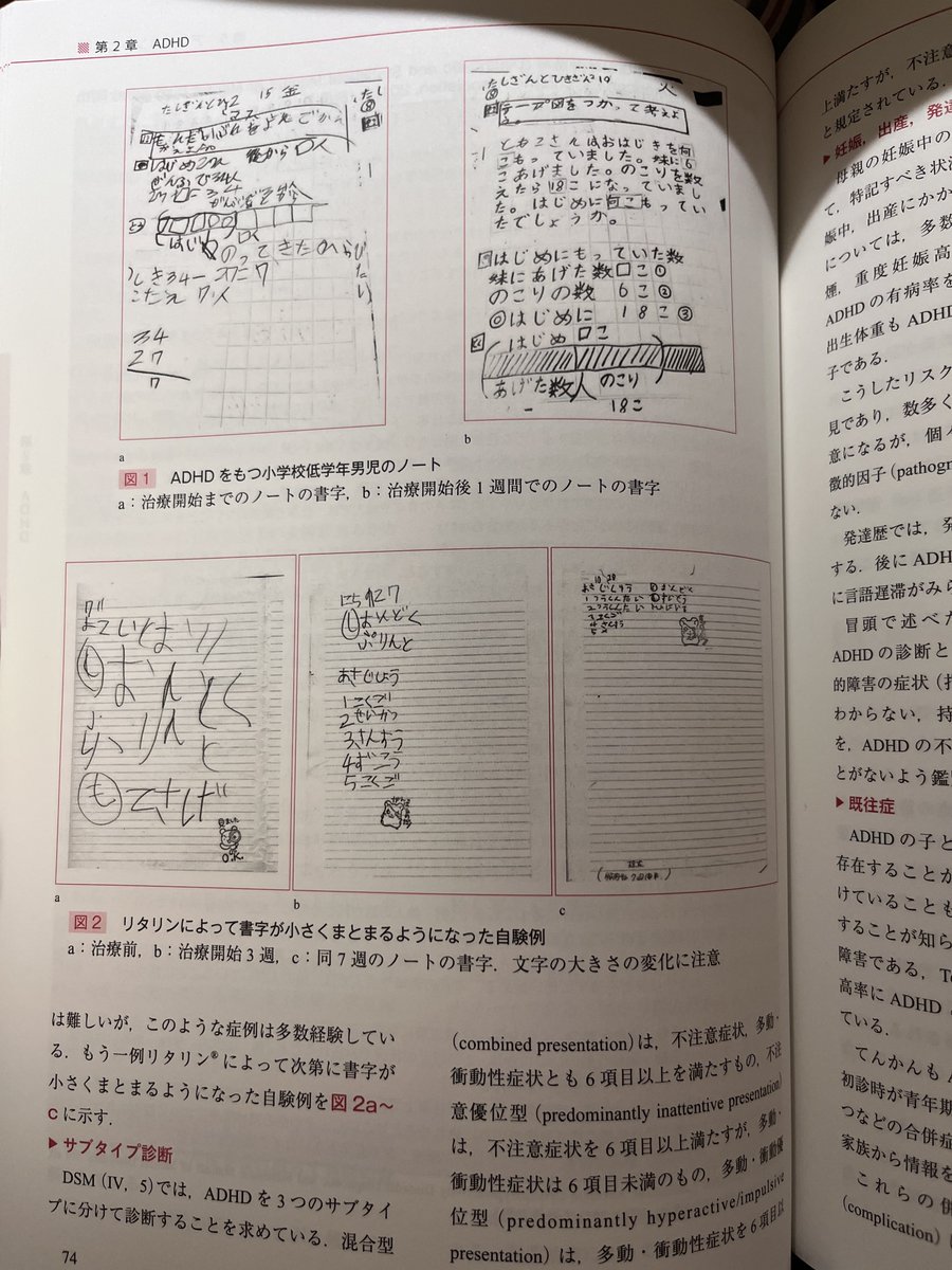 ADHDの子供をコンサータとかリタリンで治療した結果らしい
ノートの変化は視覚的にわかりやすくていいね