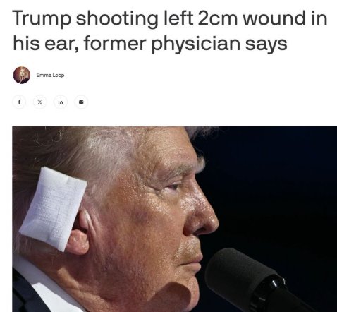 smc429's tweet image. Former physician. lol 
Ronny lost his license to practice medicine. 
Ever hear of an ear losing 2cm and not leaving a mark?