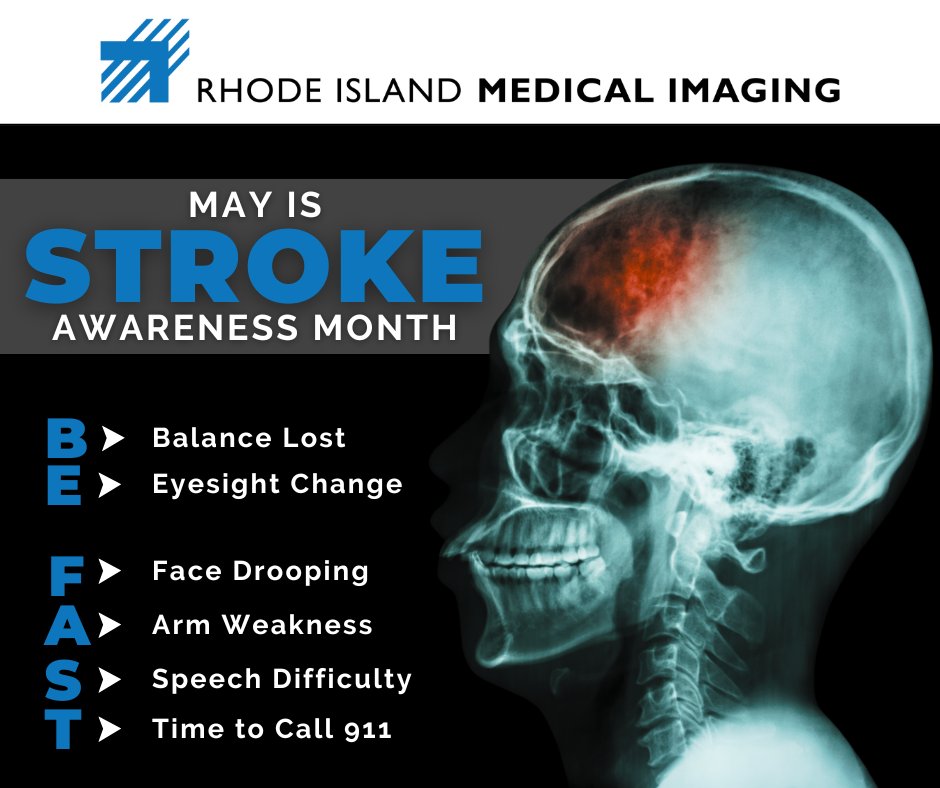 See the signs? Act FAST. May is National Stroke Awareness Month. Familiarize yourself with the “BE FAST” warning signs for strokes. Quick recognition and a call to 911 is the best way to facilitate immediate care and reduce the chance for devastating effects. #StrokeAwareness