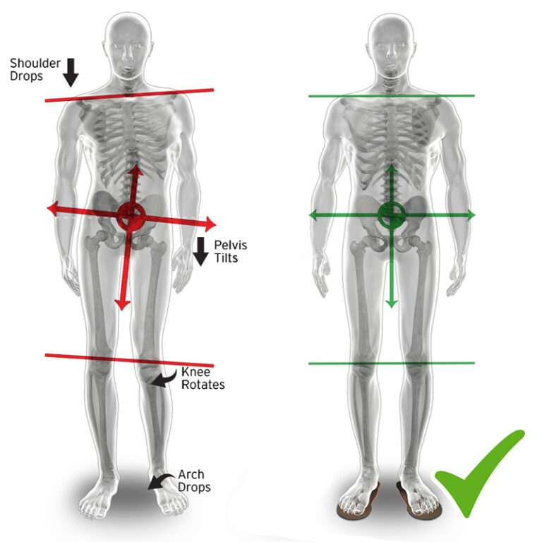 zuckercole's tweet photo. Your body has an effortless power creation system:

• It gives martial artists explosive strength
• Makes dancers float like water
• Let's athletes move with grace

But it's BROKEN in 68% of adults...

Here's the simple fix to optimizing your kinetic chain: 🧵 https://t.co/UWyNXd9bYq