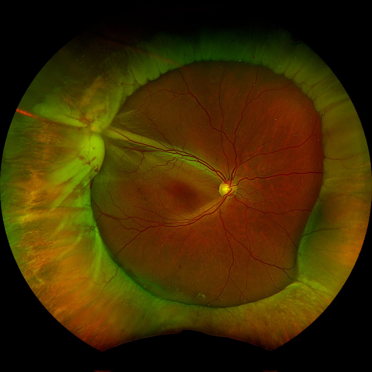 Dr. Martín Barrios-Fernández MD, MSc 👁 tweet media