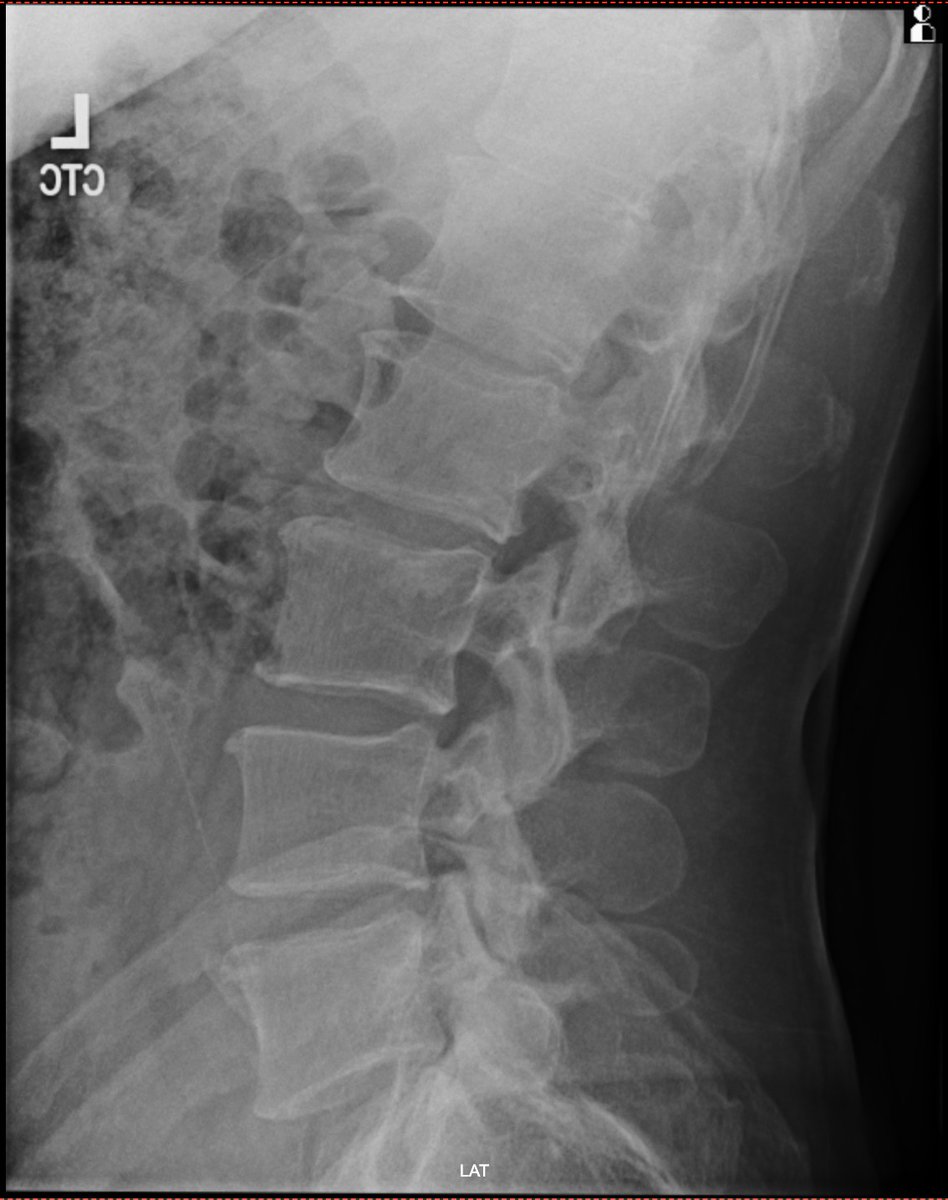 Anton Matveev, MD, RMSK tweet media