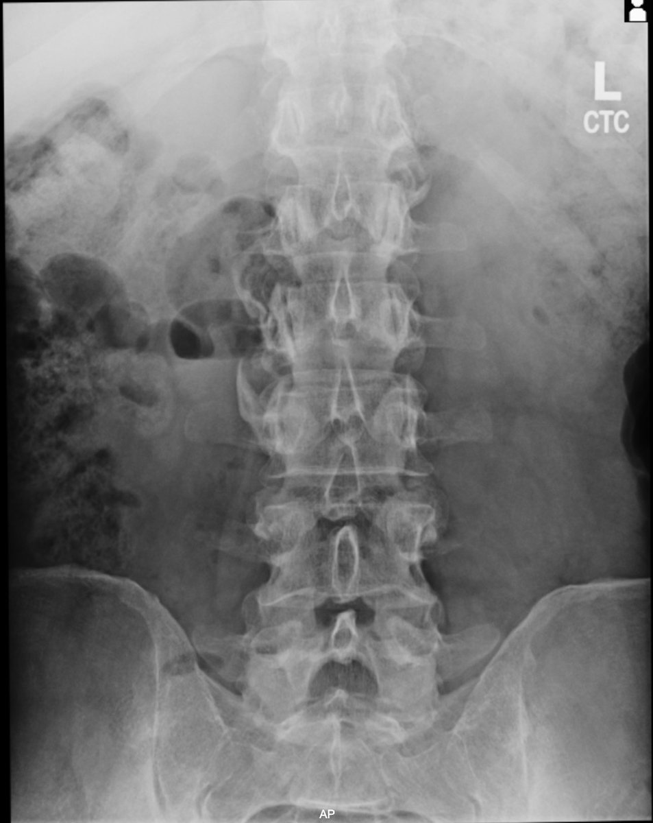 Anton Matveev, MD, RMSK tweet media