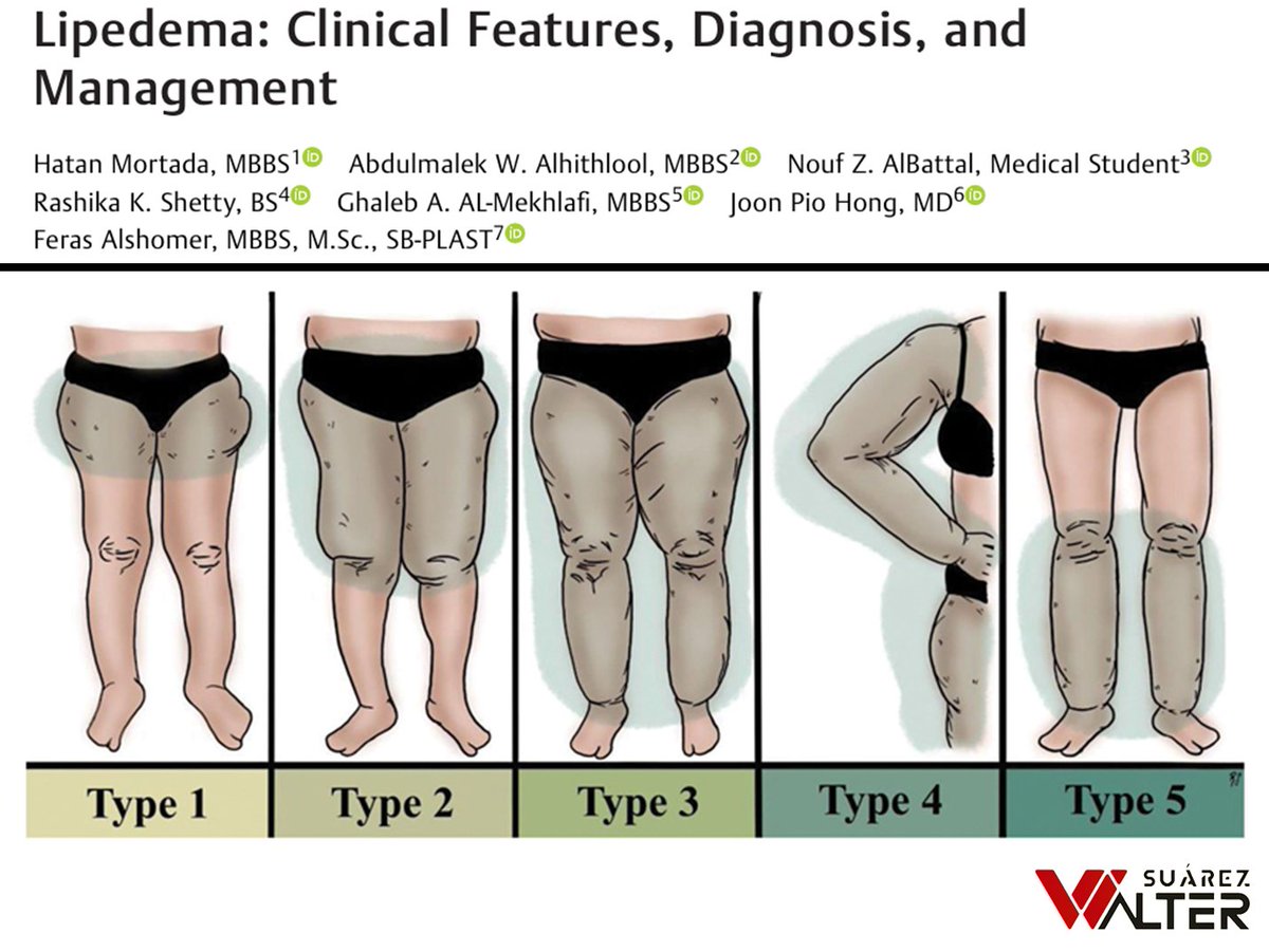 a_fisiolog57853's tweet photo. LIPEDEMA

¡¡¡A leer, zagales!!!

https://t.co/BgtVUa4k0P https://t.co/INsIOWDq1n