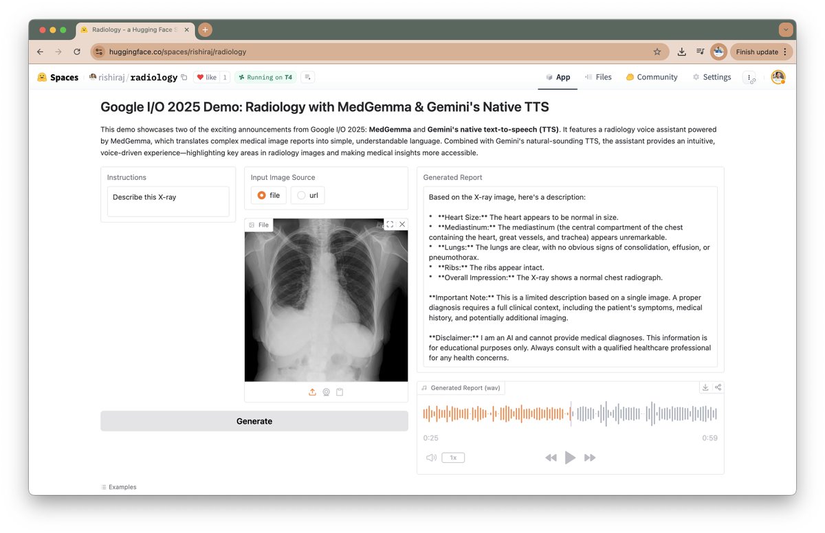 🚨 #GoogleIO 2025 Demo 🚨

Built a radiology voice assistant using MedGemma + Gemini's native TTS 🧠🔊

🩻 Understand medical images
🎙️ Natural voice response with Gemini
🔥 See it live:

📓 kaggle.com/code/rishiraja…
🧪 huggingface.co/spaces/rishira…

<a href="/GoogleDevExpert/">@GoogleDevExpert</a> <a href="/kaggle/">Kaggle</a> #Kaggle