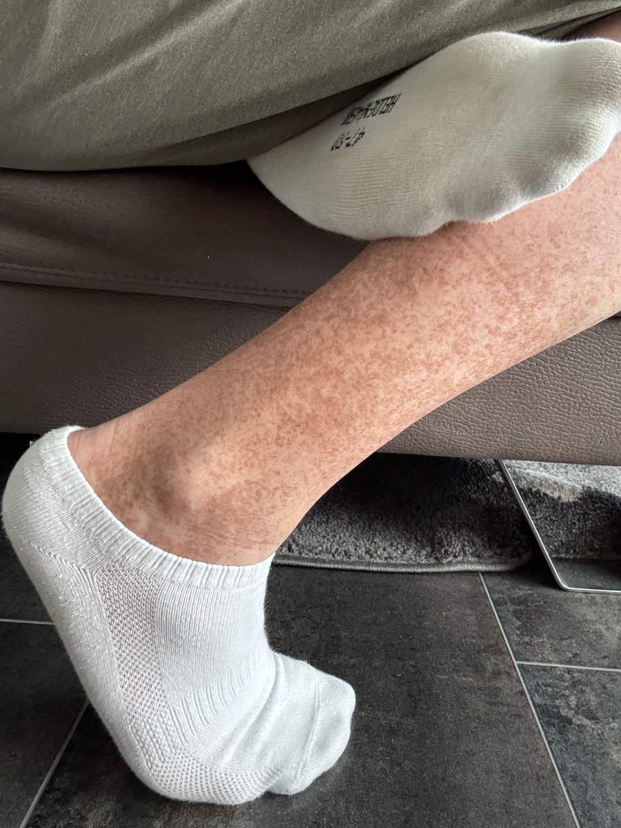 bigsock94's tweet photo. One week of wearing those socks.. really smelly. Do you like it?

#socks #anklesocks #malesocks #bigsocks #whitesocks https://t.co/NvDdLjeCma